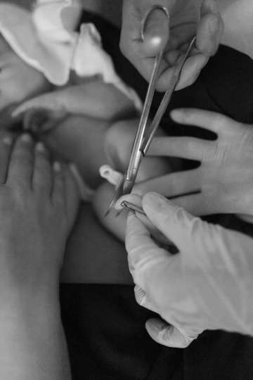 Infant surgery with attention from medical staff in a clinical setting